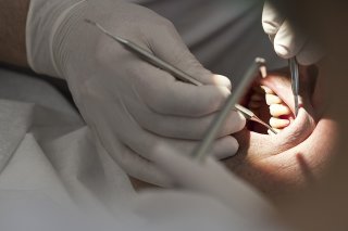 Le Conseil d’Etat valaisan a adopté un projet d’aide financière pour les soins dentaires destiné à soutenir les personnes de condition économique modeste (image d'illustration).
